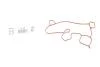 Прокладка маслоотделителя AUDI/SEAT/SKODA/VW \'\'1.8-2.0 TFSI "09>> 981.210